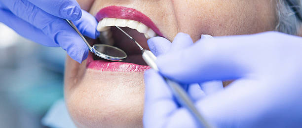 Best Emergency Dentist for Knocked-Out Tooth in Cicero, IL